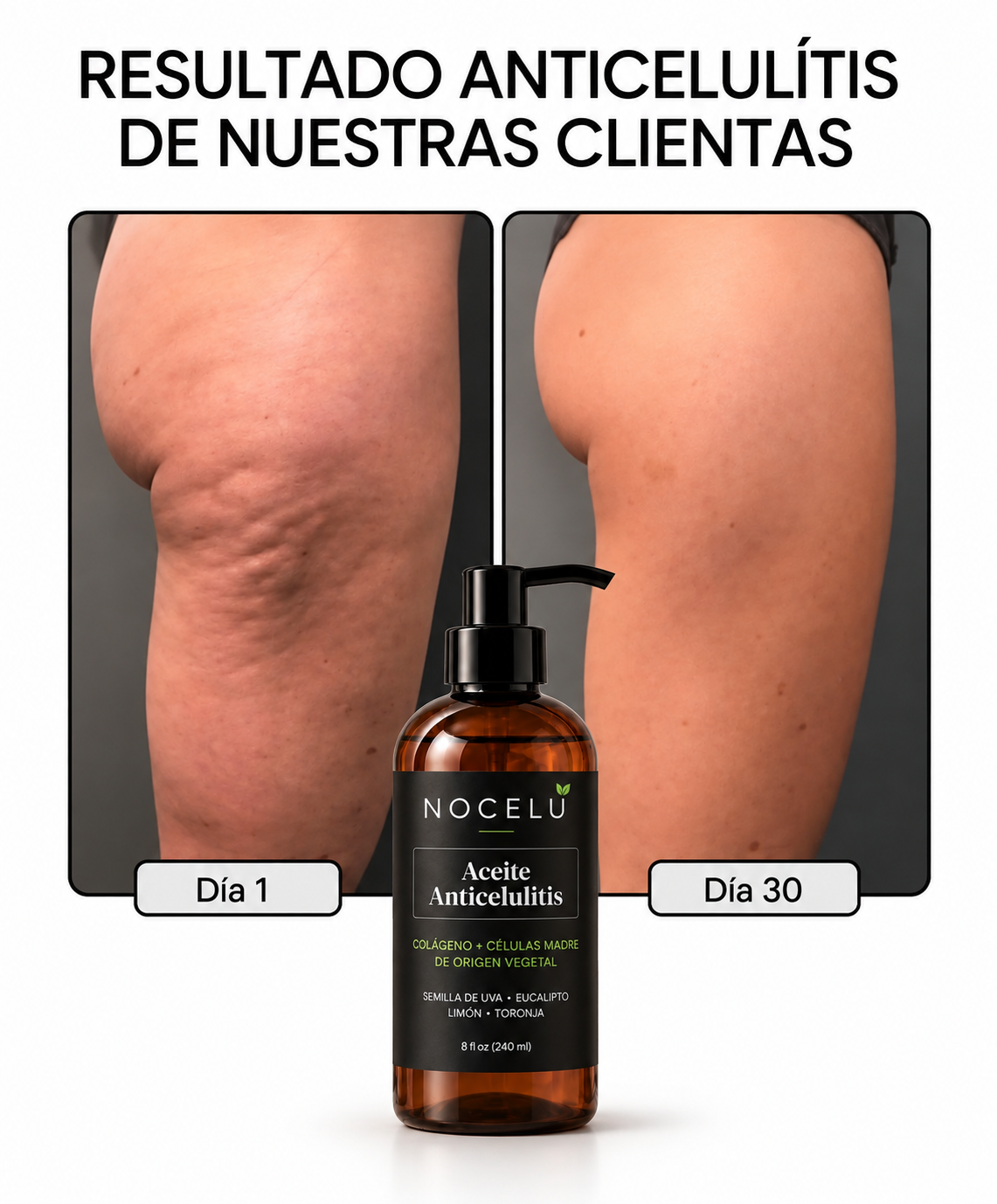 Aceite Reafirmante Anticelulitis